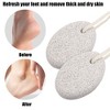 Unique Bargains Foot File Exfoliating Scrub Stone Pedicure Scrubber Natural Pumice Stone Foot Care 2 Pcs - 2 of 4