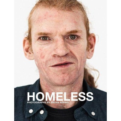 Bryan Adams: Homeless - (Hardcover)