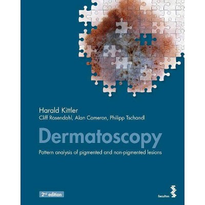 Dermatoscopy - by  Harald Kittler & Cliff Rosendahl & Alan Cameron (Paperback)