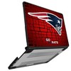 NFL AFC Teams Brick Wall Laptop Case for Apple MacBook - 2 of 4