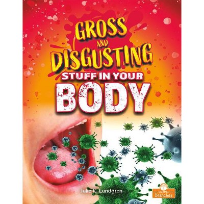 Gross and Disgusting Stuff in Your Body - (Gross and Disgusting Things) by  Julie K Lundgren (Paperback)