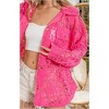 Women's Oversized Lace Shacket - BiBi - 2 of 2