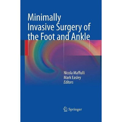 Minimally Invasive Surgery of the Foot and Ankle - by  Nicola Maffulli & Mark Easley (Paperback)