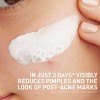 CeraVe 3in1 Acne Clay-to-Foam Facial Cleanser, Mask & Spot Treatment -  4 fl oz - 4 of 4