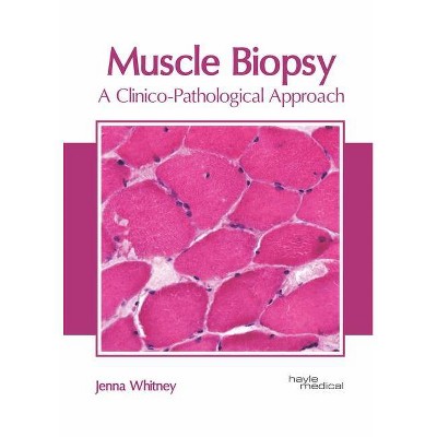 Muscle Biopsy: A Clinico-Pathological Approach - by  Jenna Whitney (Hardcover)