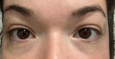 Guest review image 2 of 2, zoom in