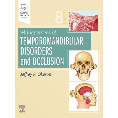 Management of Temporomandibular Disorders and Occlusion - 8th Edition by  Jeffrey P Okeson (Hardcover)