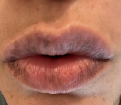 Guest review image 1 of 2, zoom in