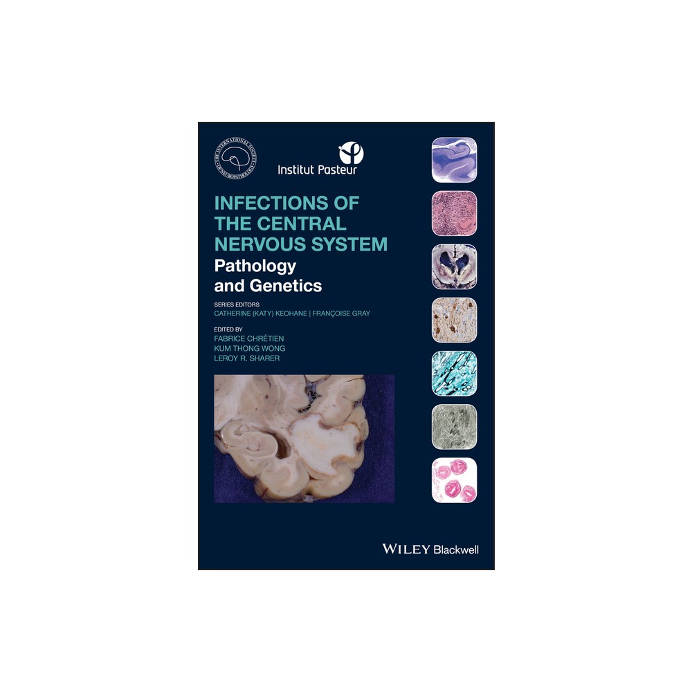 TARGET The Human Central Nervous System - 4th Edition by Rudolf ...