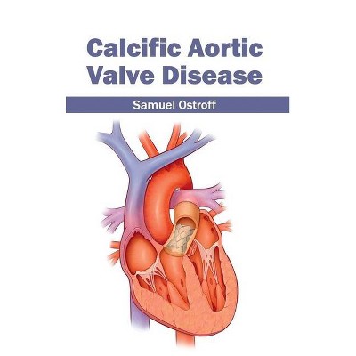 Calcific Aortic Valve Disease - by  Samuel Ostroff (Hardcover)