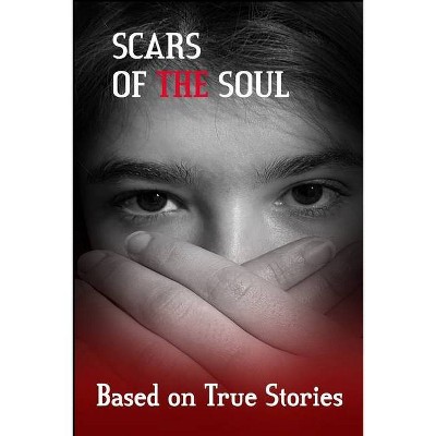 Scars of the Soul - by  Maria Aburto (Paperback)