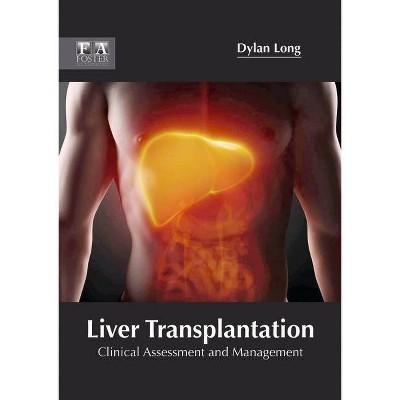 Liver Transplantation: Clinical Assessment and Management - by  Dylan Long (Hardcover)