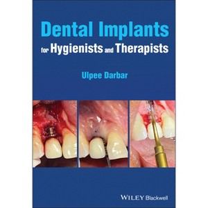 Dental Implants for Hygienists and Therapists - by  Ulpee R Darbar (Paperback) - 1 of 1