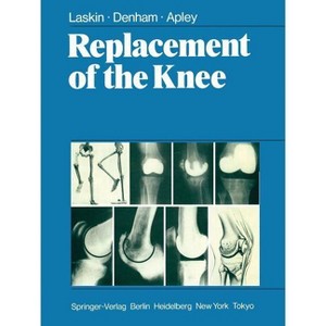 Replacement of the Knee - by  R S Laskin & R a Denham & A G Apley (Paperback) - 1 of 1