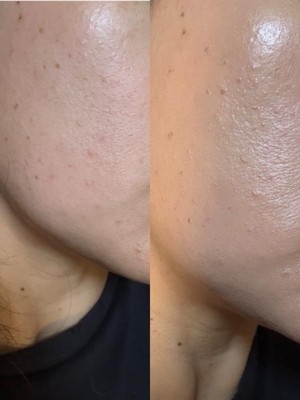 Guest review image 1 of 2, zoom in