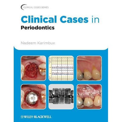 Clinical Cases in Periodontics - (Clinical Cases (Dentistry)) by  Karimbux (Paperback)