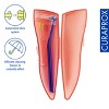 Curaprox IDB CPS 459 prime pocket Set - Premium Oral Care - 3 of 4