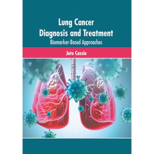 Lung Cancer Diagnosis and Treatment: Biomarker-Based Approaches - by  Jute Cassie (Hardcover) - 1 of 1