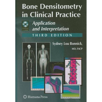 Bone Densitometry in Clinical Practice - (Current Clinical Practice (Humana)) 3rd Edition by  Sydney Lou Bonnick (Mixed Media Product)