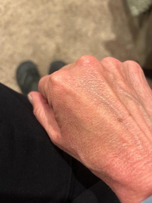 Guest review image 1 of 2, zoom in