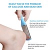 Swtroom 8 Pieces Stainless Steel Feet Files Scraper Foot Files Kit  Foot Rasp and Pedicure Tools Callus Remover Foot Grater for Dead Skin - 4 of 4