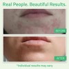 YEOUTH Glycolic Acid Facial Peel with 30% AHA and Retinol - 4 of 4