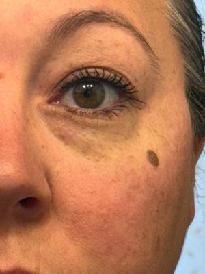 Guest review image 2 of 3, zoom in