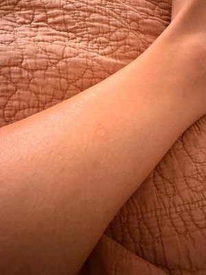 Guest review image 1 of 2, zoom in