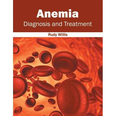 Anemia: Diagnosis and Treatment - by  Rudy Willis (Hardcover)