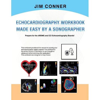Echocardiography Workbook - by  Jim Conner (Paperback)