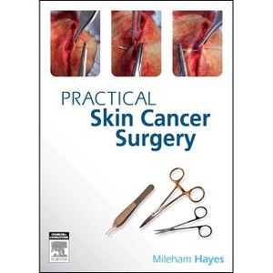 Practical Skin Cancer Surgery - by  Mileham Hayes (Paperback) - 1 of 1