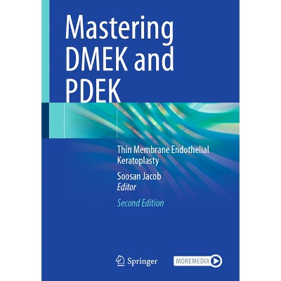 Mastering Dmek and Pdek - 2nd Edition by  Soosan Jacob (Hardcover)