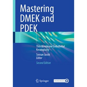 Mastering Dmek and Pdek - 2nd Edition by  Soosan Jacob (Hardcover) - 1 of 1