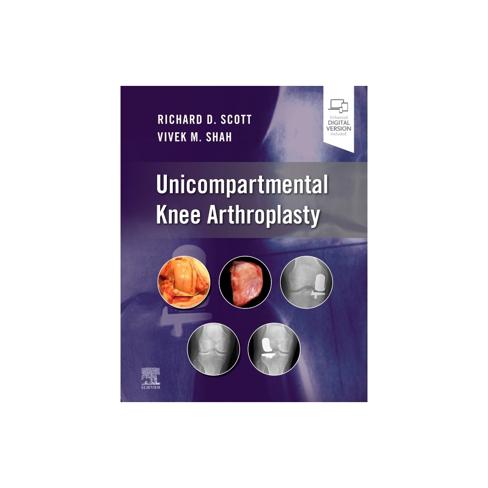 ISBN 9780323790109 product image for Unicompartmental Knee Arthroplasty - by Richard D Scott & Vivek Shah (Hardcover) | upcitemdb.com