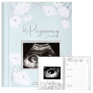 KeaBabies Blossom Pregnancy Journal, 80 Pages Hardcover Pregnancy Book for First Time Moms, Baby Memory Book - 1 of 4