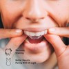 Pursonic Ultimate Teeth Whitening & Oral Care Bundle – LED Whitening Kit, Whitening Strips, & USB Rotary Toothbrush - 3 of 3
