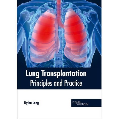 Lung Transplantation: Principles and Practice - by  Dylan Long (Hardcover)