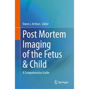 Post Mortem Imaging of the Fetus & Child - by  Owen Arthurs (Hardcover) - 1 of 1