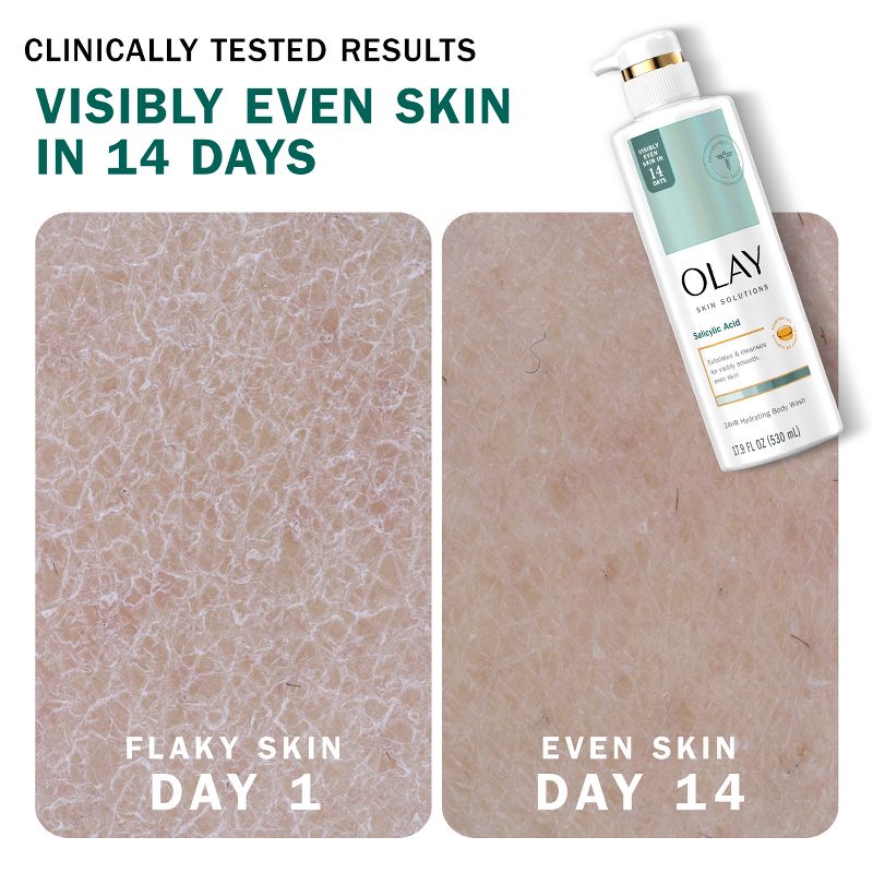 Olay Skin Solutions Body Wash with Salicylic Acid - 17.9 fl oz, 4 of 12