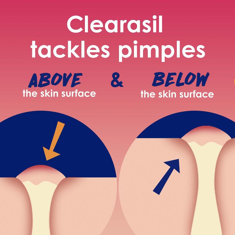 Clearasil Rapid Rescue Deep Acne Treatment - 6.78 fl oz, 3 of 11