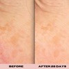 skin magic 10% Glycolic Exfoliating Treatment Tonic for Clear Bright Skin 6 fl. oz. - 4 of 4