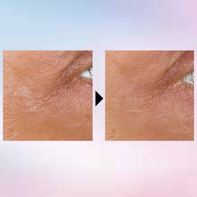 No7 Laboratories Line Correcting Booster Serum - 0.5 fl oz: Oil-Free, Paraben-Free, Contains Peptides
