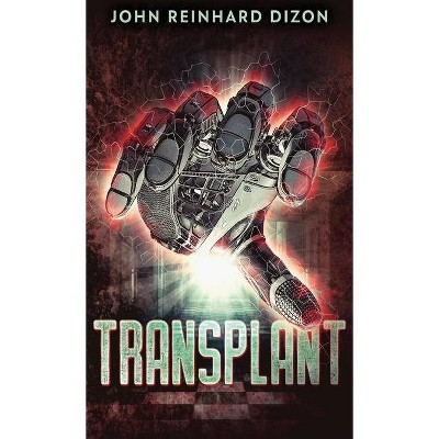 Transplant - 2nd Edition by  John Reinhard Dizon (Hardcover)