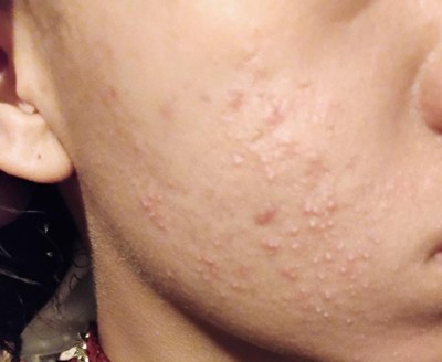 Guest review image 3 of 3, zoom in