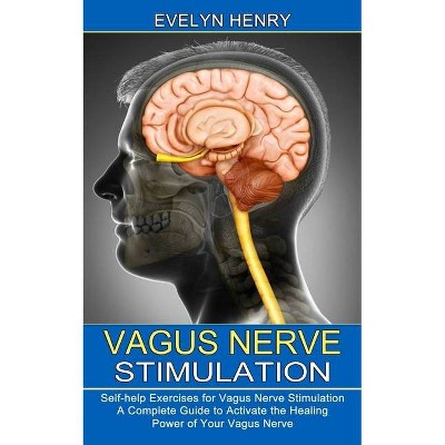 Vagus Nerve Stimulation - by  Evelyn Henry (Paperback)
