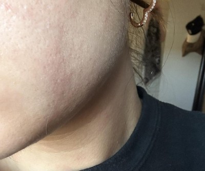 Guest review image 1 of 1, zoom in