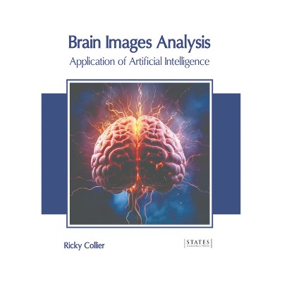 Brain Images Analysis: Application of Artificial Intelligence - by  Ricky Collier (Hardcover)