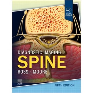 Diagnostic Imaging: Spine - 5th Edition by  Jeffrey S Ross & Kevin R Moore (Hardcover) - 1 of 1