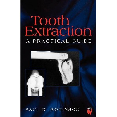 Tooth Extraction - by  Paul D Robinson (Paperback)