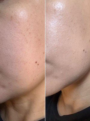 Guest review image 2 of 2, zoom in